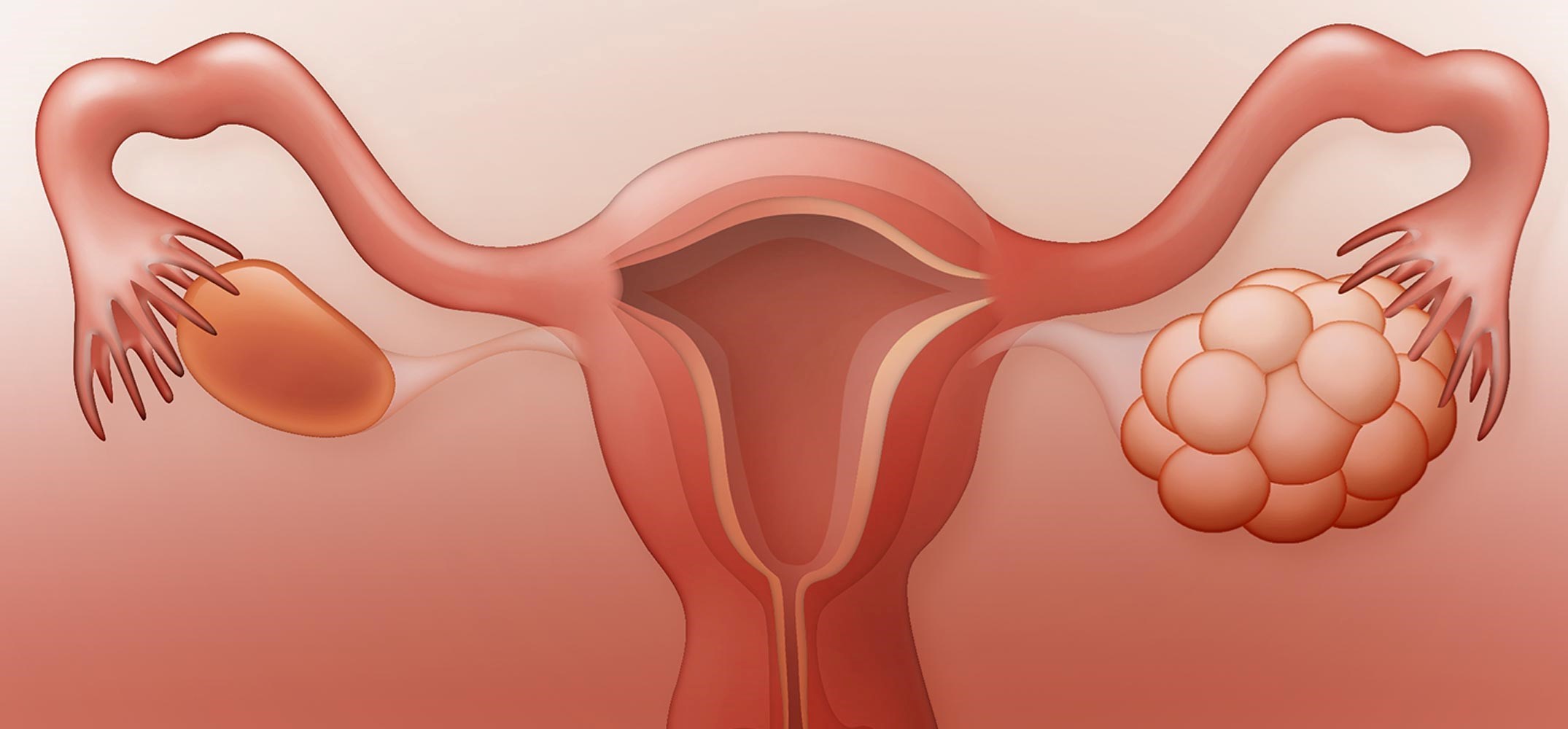 هل ارتفاع الرحم يمنع الحمل عالم حواء